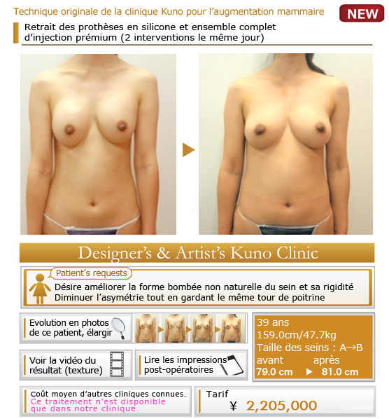 Technique originale de la clinique Kuno pour l’augmentation mammaire