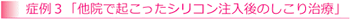 �Ǘ�R�u���@�ŋN�������V���R��������̂����莡�Áv